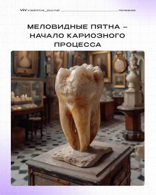 Белые пятна: обратимая стадия кариеса.